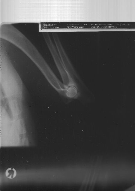 Image0006